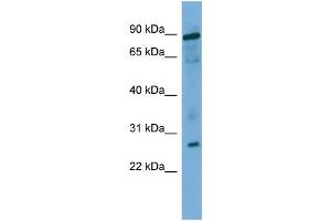 WB Suggested Anti-UBE2F Antibody Titration: 0.