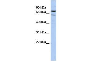 WB Suggested Anti-C1orf103 Antibody Titration: 0. (C1orf103 Antikörper  (Middle Region))