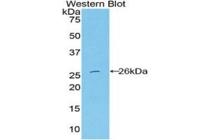 Western blot analysis of the recombinant protein. (DNASE1L2 Antikörper  (AA 32-229))