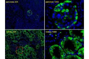 Immunofluorescence (IF) image for anti-Transthyretin (TTR) antibody (ABIN3002755) (TTR Antikörper)