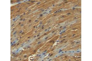 Used in DAB staining on fromalin fixed paraffin- embedded heart tissue (ANKRD1 Antikörper  (AA 6-291))