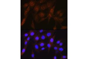 Immunofluorescence analysis of NIH-3T3 cells using PSMD4 Rabbit mAb (ABIN1681255, ABIN3017957, ABIN3017958 and ABIN7101547) at dilution of 1:100 (40x lens). (PSMD4/ASF Antikörper)