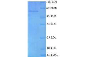 SDS-PAGE (SDS) image for Tumor Protein P53 (TP53) (AA 2-393) protein (His-SUMO Tag) (ABIN5710530) (p53 Protein (AA 2-393) (His-SUMO Tag))