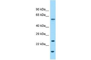 WB Suggested Anti-GPC6 Antibody Titration: 1. (Glypican 6 Antikörper  (N-Term))