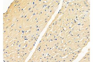 ABIN6262847 and ABIN6278586 at 1/100 staining Rat heart tissue by IHC-P. (KLHL3 Antikörper  (N-Term))