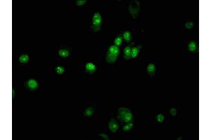 Immunofluorescence staining of MCF-7 cells with ABIN7162500 at 1:133, counter-stained with DAPI. (PAX5 Antikörper  (AA 362-391))