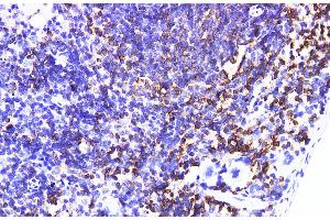Immunohistochemistry of paraffin-embedded Mouse spleen using IL6R Polyclonal Antibody at dilution of 1:200 (IL-6 Receptor Antikörper)
