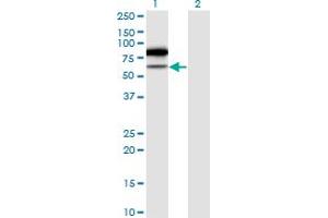 Western Blot analysis of TRMT2A expression in transfected 293T cell line by TRMT2A monoclonal antibody (M02), clone 4C10-1A11. (TRMT2A Antikörper  (AA 1-625))