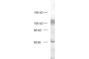 dilution: 1 : 1000, sample: crude synaptosomal fraction of rat brain (P2) (DLG3 Antikörper  (AA 14-26))