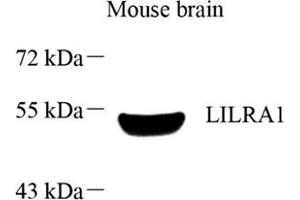 Western blot analysis of LILRA1 (ABIN7074490),at dilution of 1: 1000 (LILRA1 Antikörper)