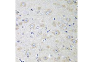 Immunohistochemistry of paraffin-embedded mouse brain using YES1 antibody (ABIN5974700) at dilution of 1/100 (40x lens). (YES1 Antikörper)