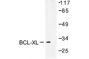 Image no. 1 for anti-BCL2-Like 1 (BCL2L1) antibody (ABIN265327) (BCL2L1 Antikörper)