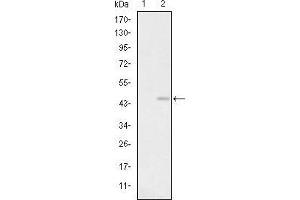 Glutamate Receptor 3 Antikörper