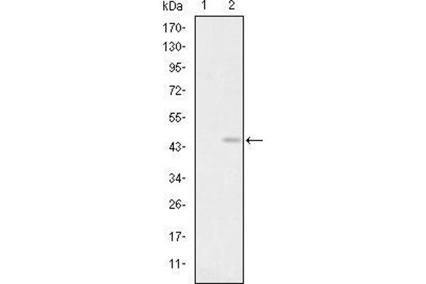 Glutamate Receptor 3 Antikörper