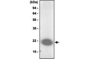 Western blot analysis of Jurkat cell lysate was resolved by SDS - PAGE , transferred to PVDF membrane and probed with PARK7 monoclonal antibody , clone 1B11 (1 : 1000)  .