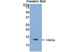 Western Blotting (WB) image for anti-Slit Homolog 2 (Drosophila) (SLIT2) (AA 1408-1519) antibody (ABIN1860578) (SLIT2 Antikörper  (AA 1408-1519))