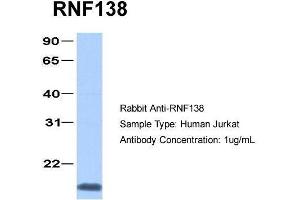 Human Jurkat; Host: Rabbit . (RNF138 Antikörper  (C-Term))
