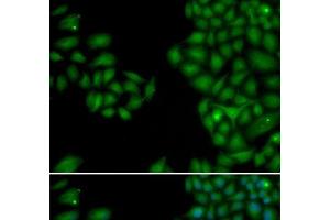 Immunofluorescence analysis of HeLa cells using NEFL Polyclonal Antibody (NEFL Antikörper)