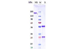 Anti-PDCD1 / PD-1 / CD279 Reference Antibody (serplulimab) on SDS-PAGE under reducing (R) condition. (Rekombinanter PDCD1 (Serplulimab Biosimilar) Antikörper)