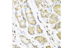 Immunohistochemistry of paraffin-embedded human stomach using MLN antibody (ABIN6128307, ABIN6143890, ABIN6143891 and ABIN6222013) at dilution of 1:100 (40x lens). (Motilin Antikörper  (AA 26-115))