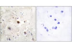 Immunohistochemistry analysis of paraffin-embedded human brain, using p57KIP2 Antibody. (CDKN1C Antikörper  (AA 11-60))