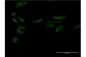 Immunofluorescence of monoclonal antibody to SP1 on HeLa cell. (SP1 Antikörper  (AA 522-618))