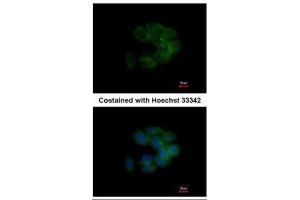 ICC/IF Image Immunofluorescence analysis of methanol-fixed HCT116, using MRCK alpha, antibody at 1:500 dilution. (CDC42BPA Antikörper)