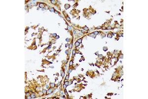 Immunohistochemistry (IHC) image for anti-Acetyl-CoA Carboxylase alpha (ACACA) antibody (ABIN7265369)