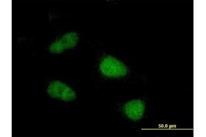 Immunofluorescence of purified MaxPab antibody to SIVA on HeLa cell.