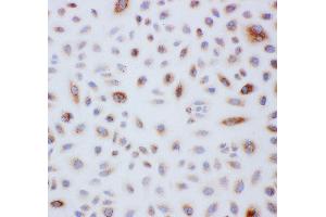 Anti-Peroxiredoxin 3 antibody, ICC ICC: A549 Cell