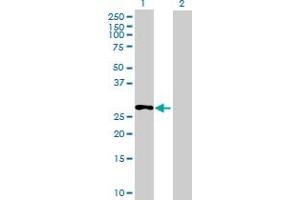 Western Blot analysis of C13orf39 expression in transfected 293T cell line ( H00196541-T01 ) by C13orf39 MaxPab polyclonal antibody. (METTL21C Antikörper  (AA 1-264))