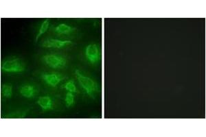 Immunofluorescence analysis of HeLa cells, using DGKI Antibody.