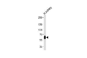 Western blot analysis of lysate from human kidney tissue lysate, using DFNB31 Antibody at 1:1000 at each lane. (DFNB31 Antikörper  (AA 378-406))