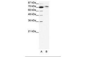 Image no. 1 for anti-Chromosome 14 Open Reading Frame 101 (C14orf101) (AA 249-298) antibody (ABIN6736042) (C14orf101 Antikörper  (AA 249-298))