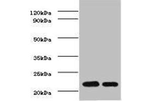 Western BlotPositive WB detected in: mouse heartAll lanes: TIMP1 antibody at 2ug/mlSecondaryGoat polyclonal to rabbit IgG at 1/50000 dilutionPredicted band size: 23 kDaObserved band size: 23 kDa. (TIMP1 Antikörper  (AA 24-207))