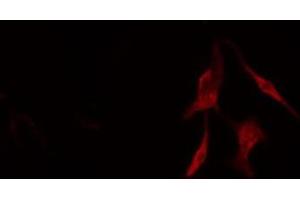ABIN6276561 staining COLO205 cells by IF/ICC. (BCL2L2 Antikörper  (N-Term))