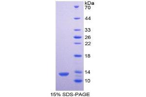 SDS-PAGE (SDS) image for Platelet Factor 4 (PF4) (AA 25-105) protein (His tag) (ABIN2121910)