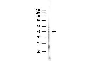 anti-Hydroxy-delta-5-Steroid Dehydrogenase, 3 beta- and Steroid delta-Isomerase 7 (HSD3B7) (Internal Region) antibody
