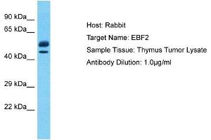 Host: Rabbit Target Name: EBF2 Sample Type: Thymus Tumor lysates Antibody Dilution: 1. (EBF2 Antikörper  (C-Term))