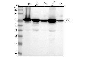 Western blot analysis of IGF2BP3 using anti-IGF2BP3 antibody (ABIN7605267).