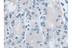 Immunohistochemistry (IHC) image for anti-Valosin Containing Protein (VCP) (AA 125-371) antibody (ABIN7440884)