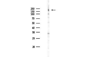 anti-Bromodomain Adjacent To Zinc Finger Domain, 2A (BAZ2A) (N-Term) antibody