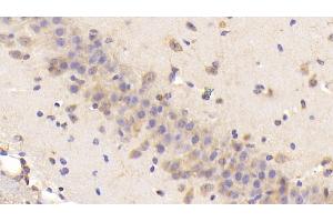 Detection of BNP in Mouse Cerebrum Tissue using Polyclonal Antibody to Brain Natriuretic Peptide (BNP) (BNP Antikörper  (AA 77-121))