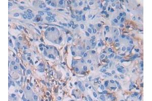 Immunohistochemistry (IHC) image for anti-Major Histocompatibility Complex, Class II, DR beta 1 (HLA-DRB1) (AA 30-266) antibody (ABIN7440764)
