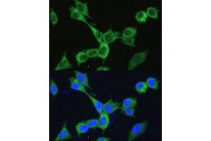 Immunofluorescence analysis of NIH-3T3 cells using MTHFD2 antibody (ABIN6132367, ABIN6144144, ABIN6144145 and ABIN6214625) at dilution of 1:100.