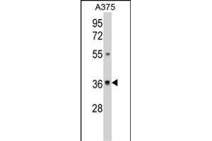Western blot analysis of GALE Antibody (Center) (ABIN390889 and ABIN2841099) in  cell line lysates (35 μg/lane). (GALE Antikörper  (AA 142-171))