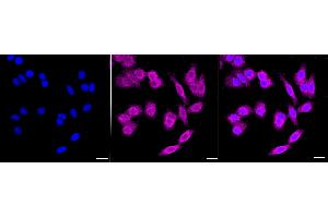 Immunocytochemical staining of HepG2 cells with Ferritin heavy chain 1 antibody (ABIN7798596), 1:1,000). (Rekombinanter FTH1 Antikörper)