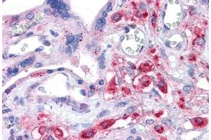 Immunohistochemistry (IHC) image for anti-Solute Carrier Family 7, (Cationic Amino Acid Transporter, Y+ System) Member 11 (SLC7A11) (Internal Region) antibody (ABIN190899)