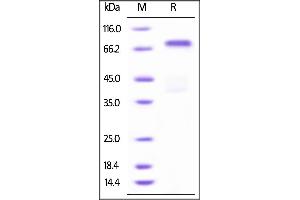 SDS-PAGE (SDS) image for Met Proto-Oncogene (MET) (AA 25-932) (Active) protein (His tag,AVI tag,Biotin) (ABIN3137684)