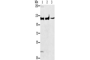 Western Blotting (WB) image for anti-Mitogen-Activated Protein Kinase 7 (MAPK7) antibody (ABIN5547486) (MAPK7 Antikörper)